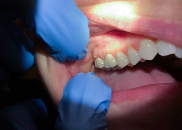 Best Pediatric Emergency Dentist in Corvallis, MT